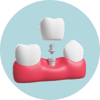 Если нужна имплантация, удаление зубов, сложная хирургия