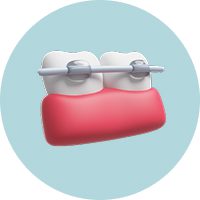 Если зубы неровные