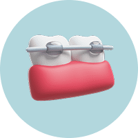 Если зубы неровные